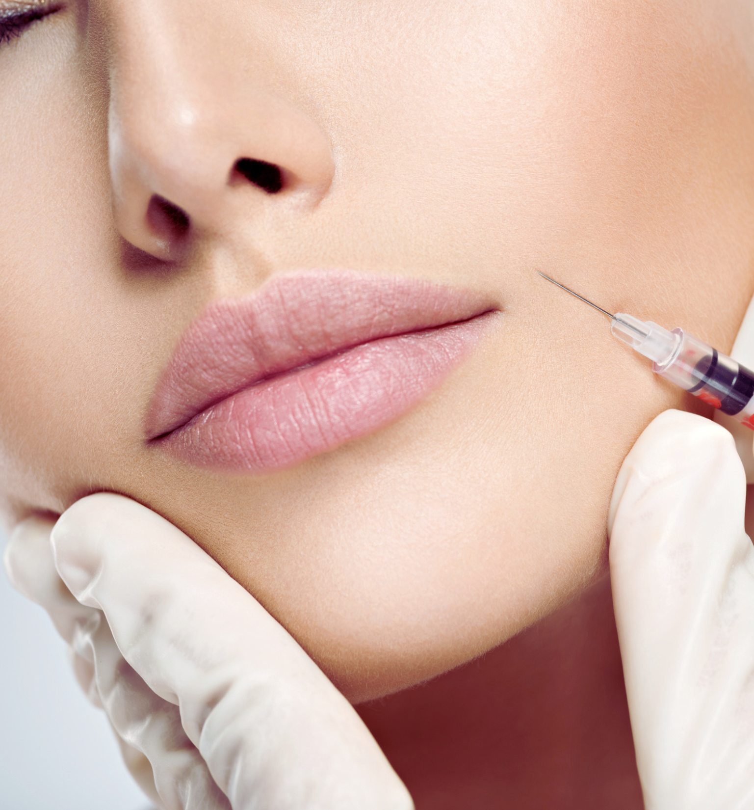Dermal Fillers